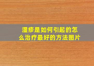 湿疹是如何引起的怎么治疗最好的方法图片