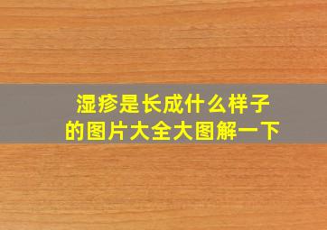 湿疹是长成什么样子的图片大全大图解一下