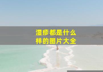 湿疹都是什么样的图片大全