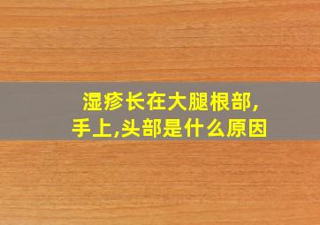 湿疹长在大腿根部,手上,头部是什么原因