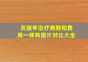 灰指甲治疗周期和费用一样吗图片对比大全