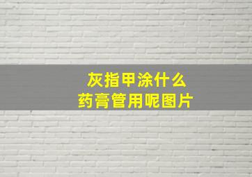 灰指甲涂什么药膏管用呢图片