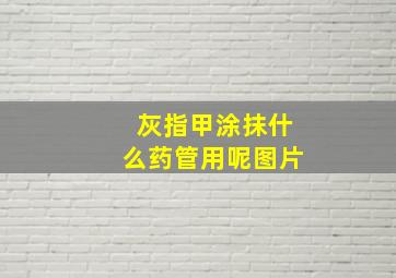 灰指甲涂抹什么药管用呢图片