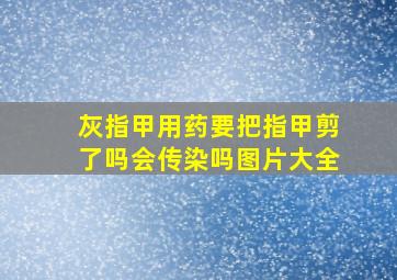 灰指甲用药要把指甲剪了吗会传染吗图片大全