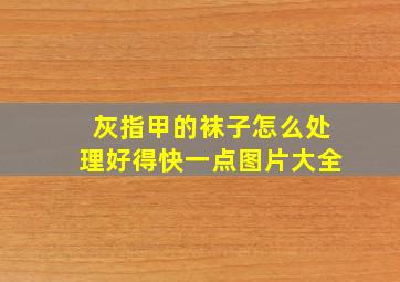 灰指甲的袜子怎么处理好得快一点图片大全