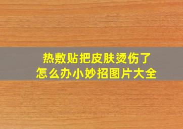 热敷贴把皮肤烫伤了怎么办小妙招图片大全