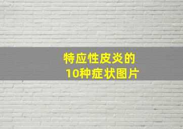 特应性皮炎的10种症状图片