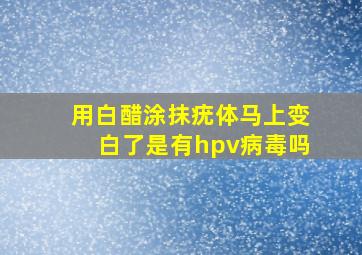 用白醋涂抹疣体马上变白了是有hpv病毒吗