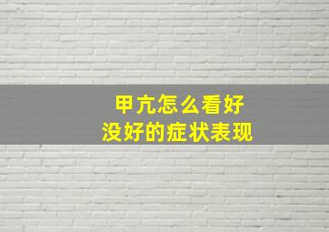 甲亢怎么看好没好的症状表现