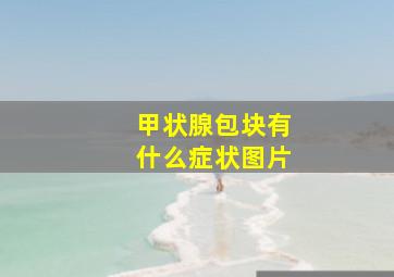 甲状腺包块有什么症状图片