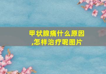 甲状腺痛什么原因,怎样治疗呢图片