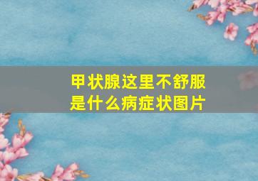 甲状腺这里不舒服是什么病症状图片