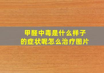 甲醛中毒是什么样子的症状呢怎么治疗图片