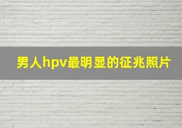 男人hpv最明显的征兆照片