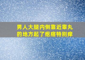 男人大腿内侧靠近睾丸的地方起了疙瘩特别痒