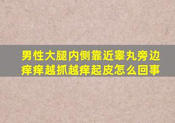 男性大腿内侧靠近睾丸旁边痒痒越抓越痒起皮怎么回事