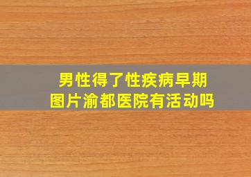 男性得了性疾病早期图片渝都医院有活动吗