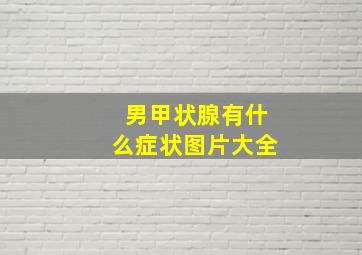 男甲状腺有什么症状图片大全