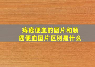 痔疮便血的图片和肠癌便血图片区别是什么