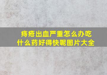 痔疮出血严重怎么办吃什么药好得快呢图片大全