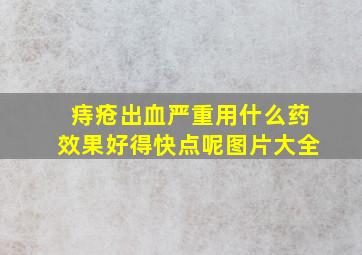 痔疮出血严重用什么药效果好得快点呢图片大全