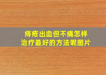 痔疮出血但不痛怎样治疗最好的方法呢图片