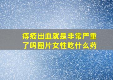 痔疮出血就是非常严重了吗图片女性吃什么药