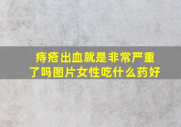 痔疮出血就是非常严重了吗图片女性吃什么药好