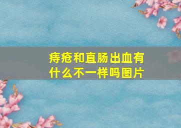 痔疮和直肠出血有什么不一样吗图片