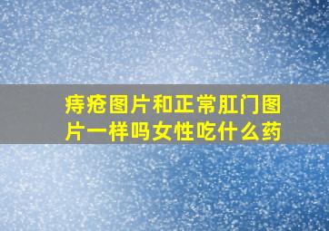 痔疮图片和正常肛门图片一样吗女性吃什么药