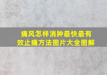 痛风怎样消肿最快最有效止痛方法图片大全图解