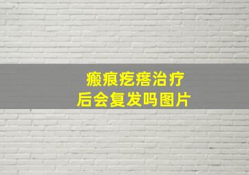 瘢痕疙瘩治疗后会复发吗图片