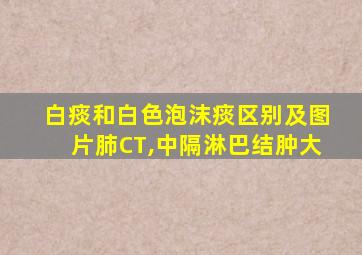 白痰和白色泡沫痰区别及图片肺CT,中隔淋巴结肿大