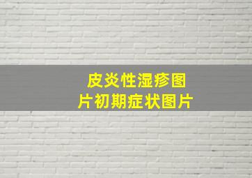 皮炎性湿疹图片初期症状图片