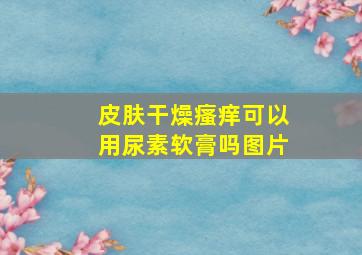 皮肤干燥瘙痒可以用尿素软膏吗图片