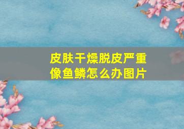 皮肤干燥脱皮严重像鱼鳞怎么办图片