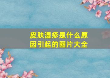 皮肤湿疹是什么原因引起的图片大全