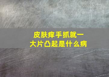 皮肤痒手抓就一大片凸起是什么病