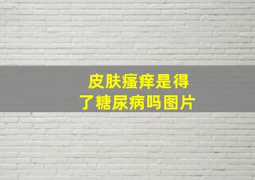 皮肤瘙痒是得了糖尿病吗图片