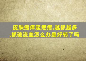 皮肤瘙痒起疙瘩,越抓越多,抓破流血怎么办是好转了吗