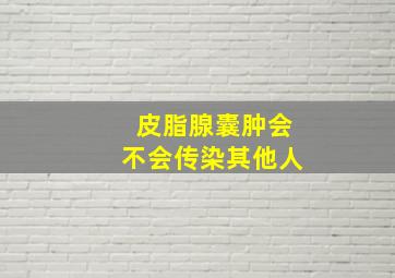 皮脂腺囊肿会不会传染其他人