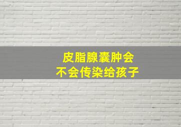 皮脂腺囊肿会不会传染给孩子