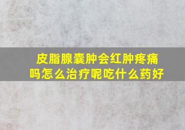 皮脂腺囊肿会红肿疼痛吗怎么治疗呢吃什么药好