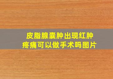 皮脂腺囊肿出现红肿疼痛可以做手术吗图片