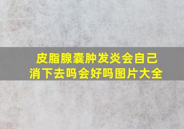 皮脂腺囊肿发炎会自己消下去吗会好吗图片大全