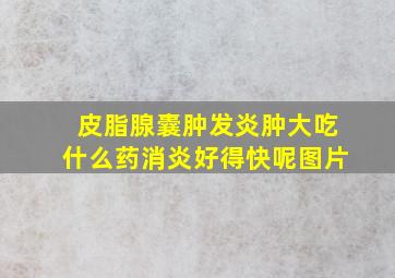 皮脂腺囊肿发炎肿大吃什么药消炎好得快呢图片