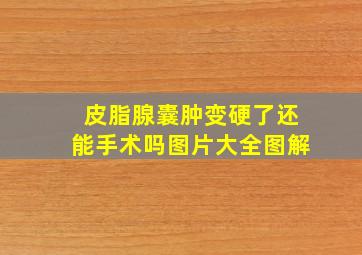 皮脂腺囊肿变硬了还能手术吗图片大全图解