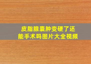 皮脂腺囊肿变硬了还能手术吗图片大全视频