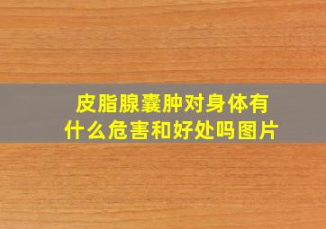 皮脂腺囊肿对身体有什么危害和好处吗图片