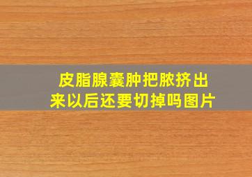 皮脂腺囊肿把脓挤出来以后还要切掉吗图片